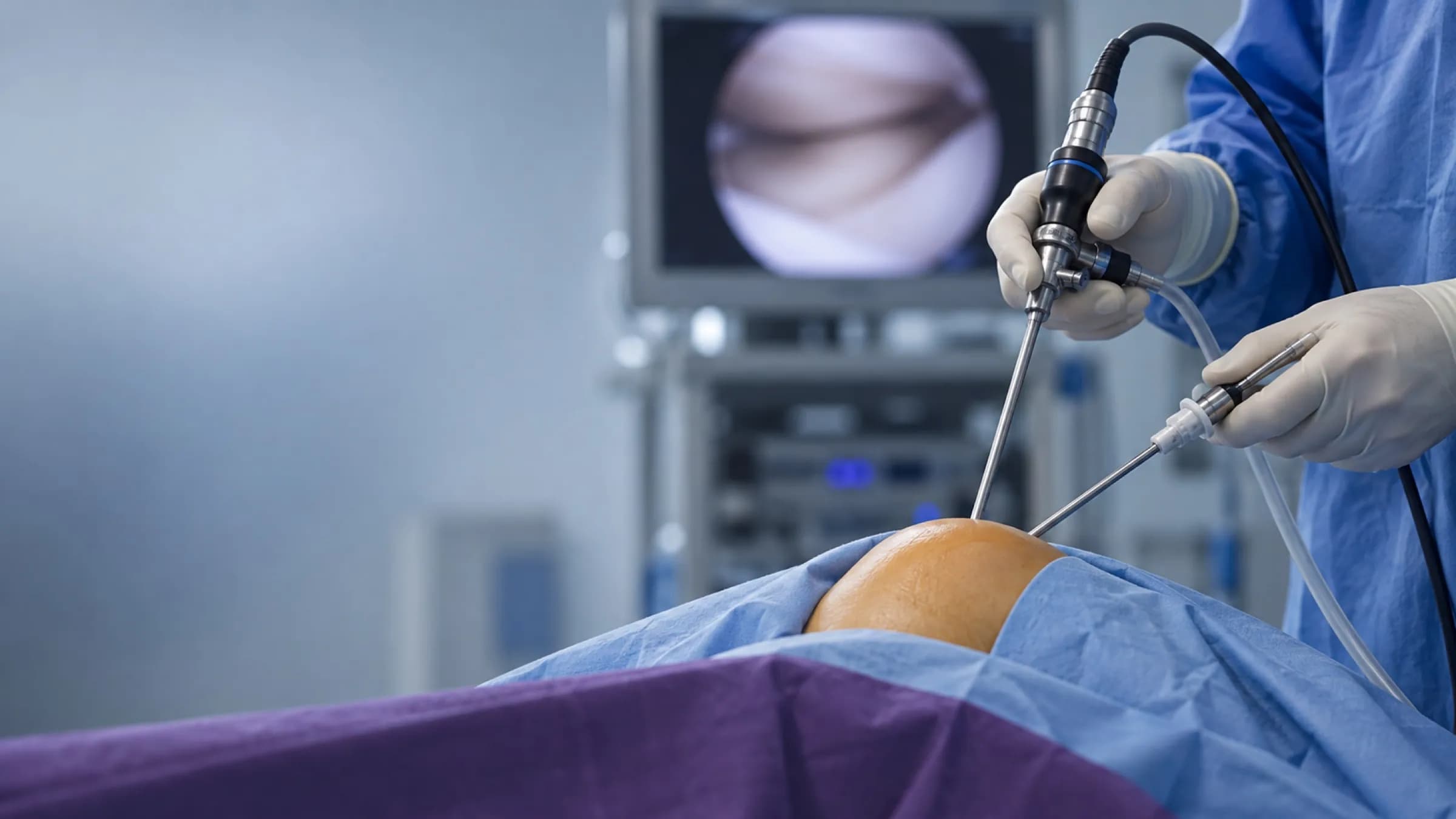A surgeon's gloved hands holding an arthroscope and a slim applicator cannula over a draped knee