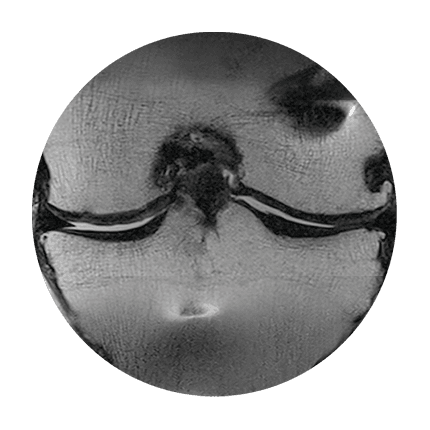 MRI follow-up scan of a knee joint, manufacturer material, view 2