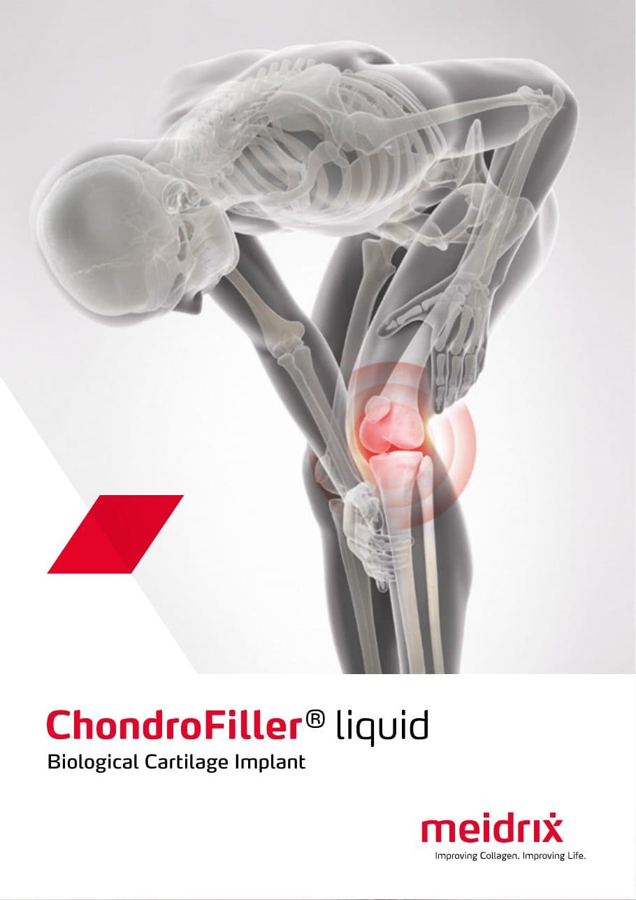Cover of ChondroFiller® liquid overview brochure